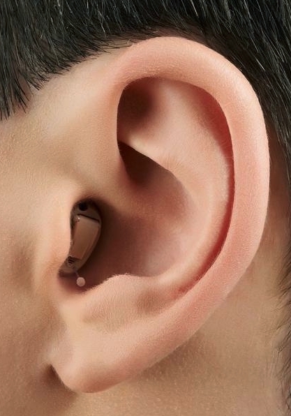 Im-Ohr - Hörsysteme